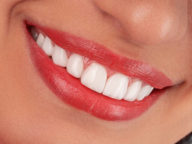 Dentista Salerno: visite e trattamenti con Dott. Luongo
